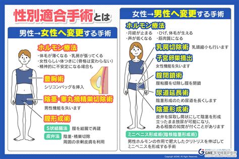 性別確認手術 あなたの性別を確認する手術 